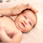 torcicollo del neonato